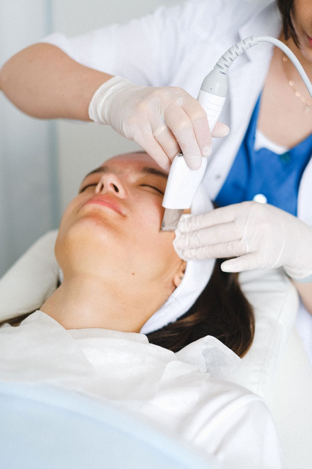 Hair loss & PRP